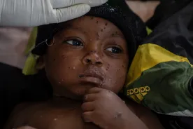 1st mpox vaccine for children approved by WHO