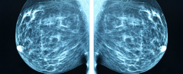 AI Can Predict Breast Cancer Risk Years Before Diagnosis, Study Finds