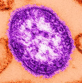 Five cases of measles reported in Manitoba connected to Ontario outbreak