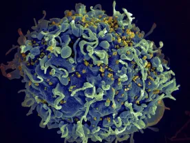 B.C. men with HIV live longer than women: study