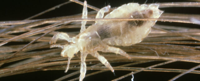 Head Lice Are Digging In, But There's a Simple Way to Get Rid of Them